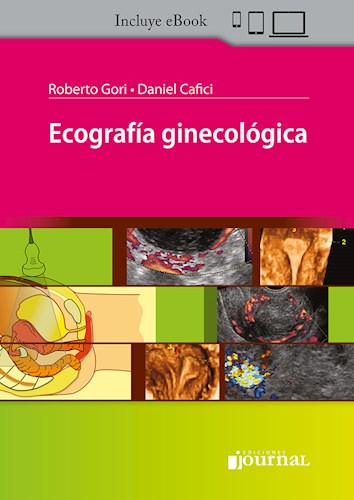 Ecografía Ginecológica