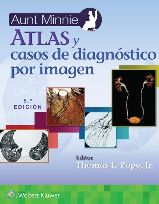 Aunt Minnie. Atlas y casos de diagnóstico por imagen