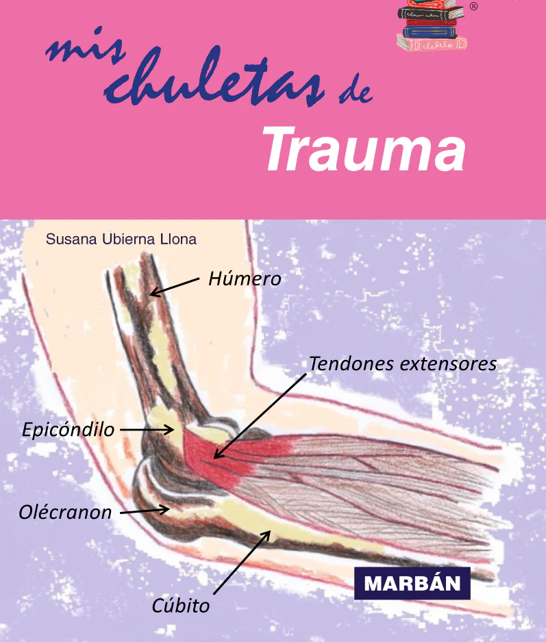 Mis chuletas (acordeones) de Trauma - Ubierna