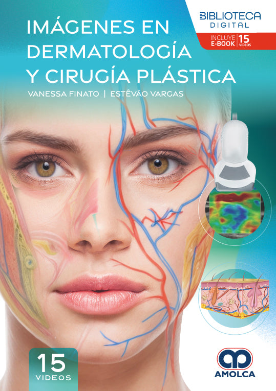 Imágenes en dermatología y cirugía plástica