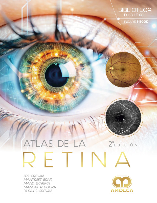 Atlas de la retina. 2ª edición