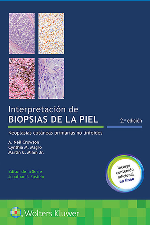 Interpretación de biopsias de la piel