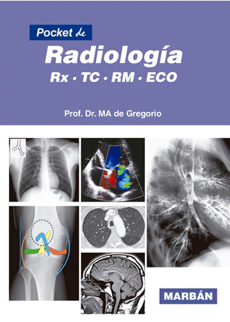 Pocket de Radiología. RX, TC, RM, ECO
