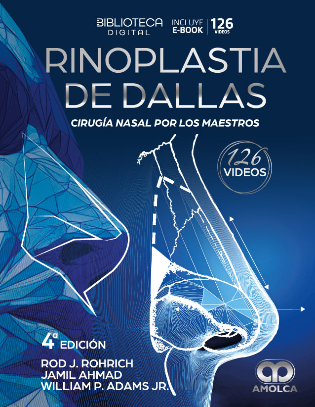 Rinoplastia de Dallas. Cirugía nasal por los maestros 4ª edición