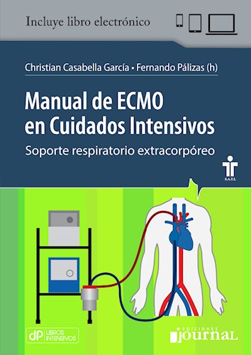 Manual de ECMO en Cuidados Intensivos