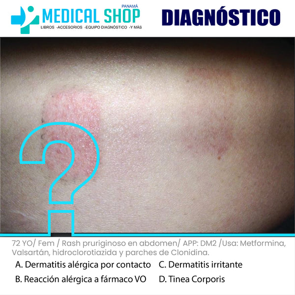 Quiz: Dermatitis alérgica por contacto