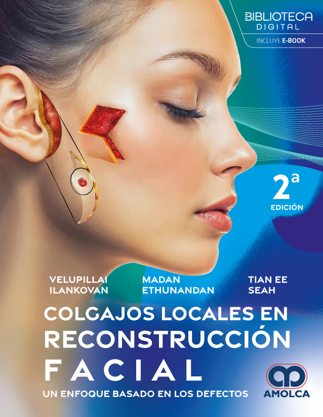 Colgajos locales en reconstrucción facial. Un enfoque basado en los defectos