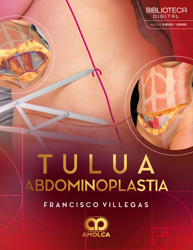 Tulua Abdominoplastia