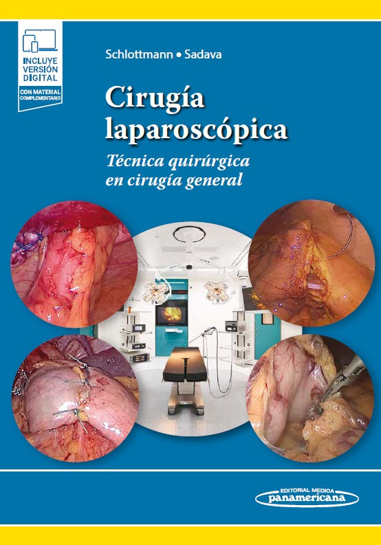 Cirugía laparoscópica