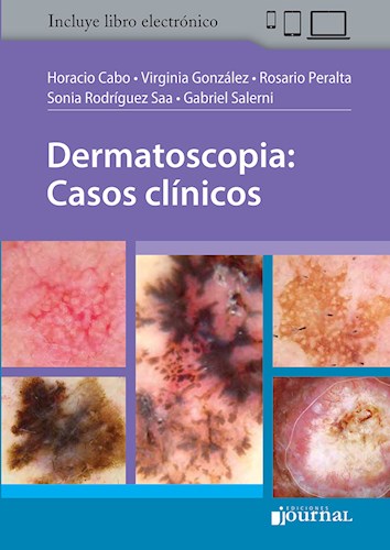 Dermatoscopia: Casos clínicos