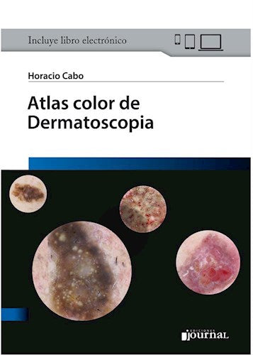 Atlas color de Dermatoscopia