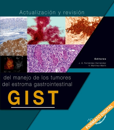 Actualización y Revisión del Manejo de los tumores del estroma gastrointestinal