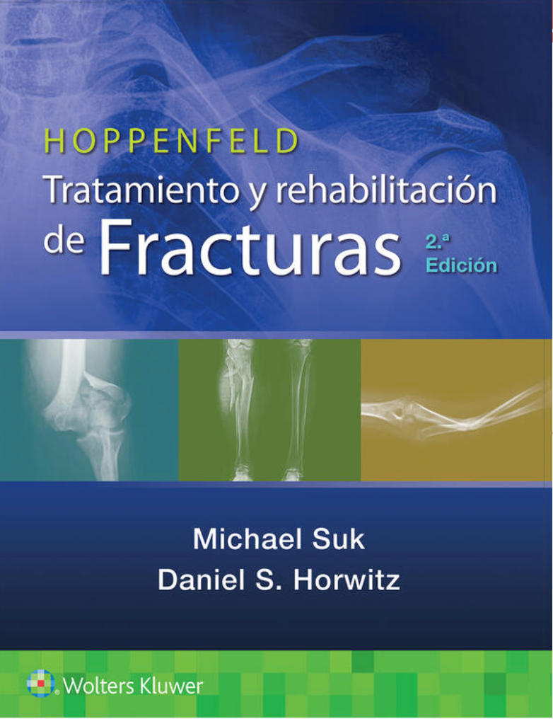 Hoppenfeld. Tratamiento y rehabilitación de fracturas