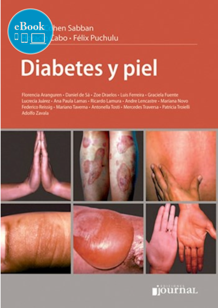 Diabetes y piel