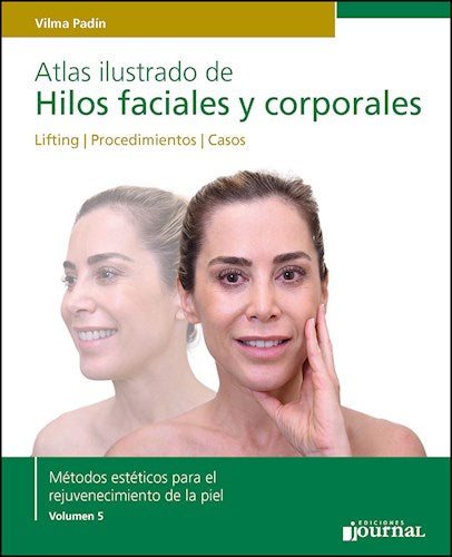 Atlas ilustrado de Hilos faciales y corporales