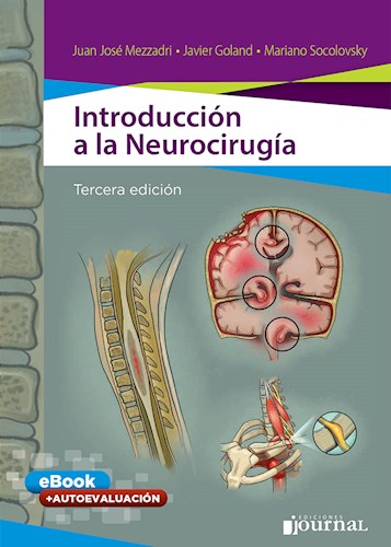 Introducción a la Neurocirugía Ed.3º