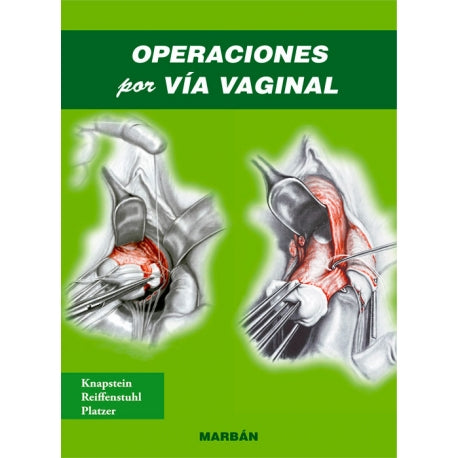 Operaciones por Vía Vaginal