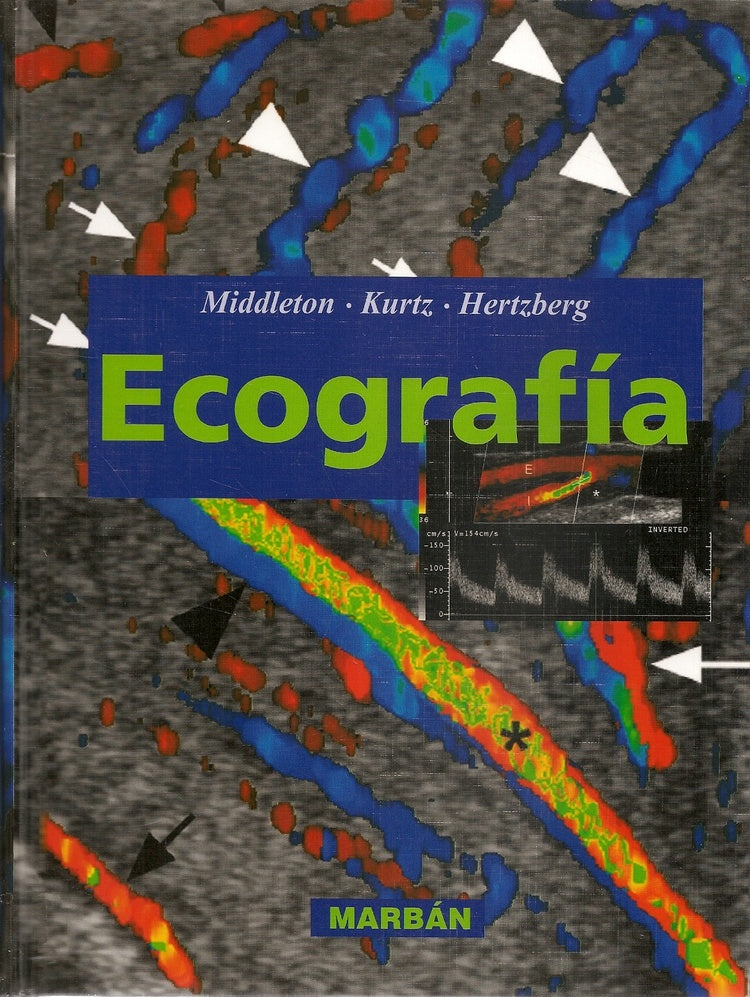 Ecografía. Middleton-Kurtz-Hertzberg