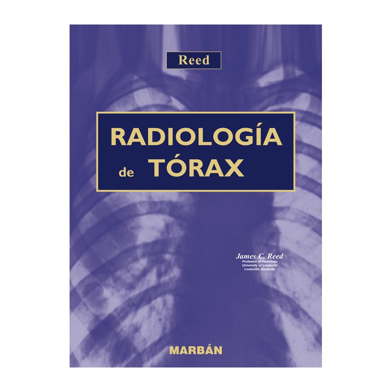 Radiología de Tórax de Reed