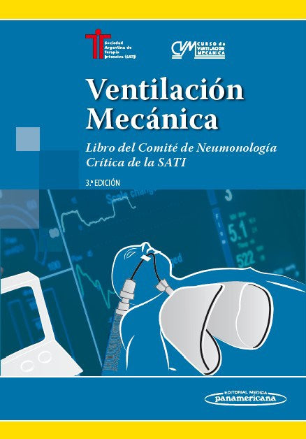 Ventilación Mecánica