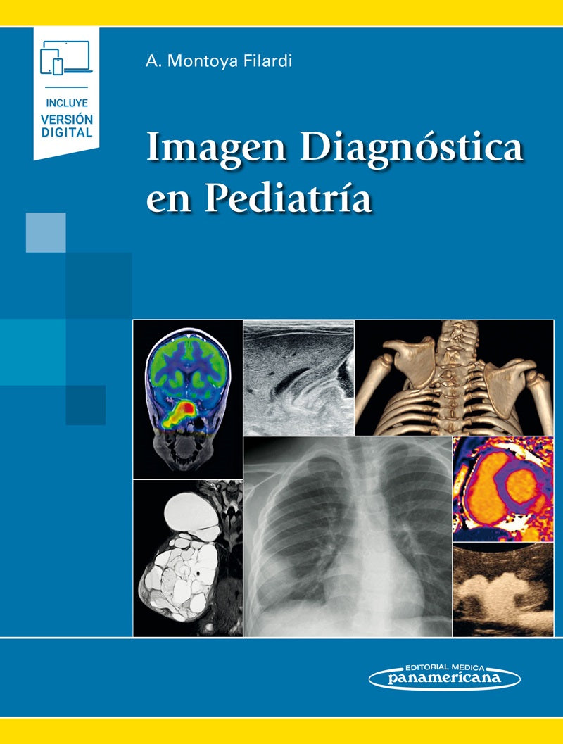 Imagen Diagnóstica en Pediatría
